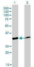 Anti-PPIE Antibody