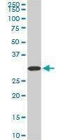 Anti-PPIE Antibody
