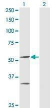 Anti-PPOX Antibody