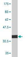 Anti-PPOX Antibody