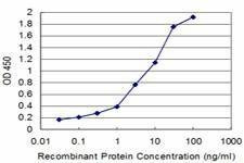 Anti-PPOX Antibody