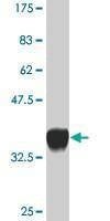 Anti-PPOX Antibody