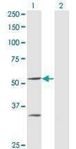Anti-PPOX Antibody