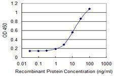 Anti-PQBP1 Antibody