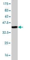 Anti-PRDM4 Antibody
