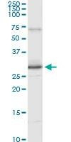 Anti-PRDX3 Antibody
