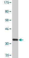 Anti-PRDX4 Antibody