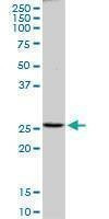 Anti-PRDX4 Antibody