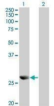 Anti-PRDX4 Antibody