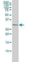 Anti-PRKAB2 Antibody
