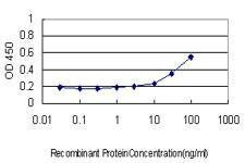 Anti-PRKAB2 Antibody