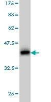 Anti-PRKCD Antibody