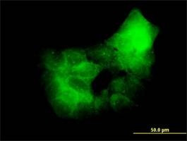 Anti-PRKCD Antibody