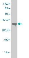 Anti-PRKG1 Antibody