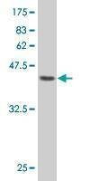 Anti-PRKRIP1 Antibody
