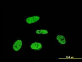 Anti-PRKRIP1 Antibody