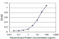 Anti-PRKRIP1 Antibody