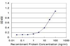 Anti-PRODH Antibody