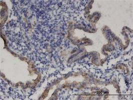 Anti-PRODH Antibody