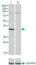 Anti-PRPS2 Antibody