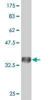 Anti-PRRG2 Antibody