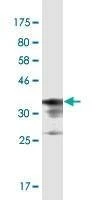 Anti-PRSS12 Antibody