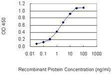 Anti-PRSS12 Antibody