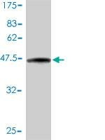 Anti-PSCD3 Antibody