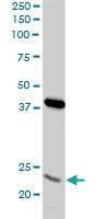 Anti-PSMA8 Antibody