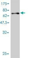 Anti-PSMC4 Antibody