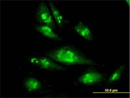 Anti-PSMC4 Antibody