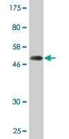 Anti-PSMD10 Antibody