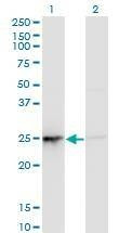 Anti-PSMD10 Antibody