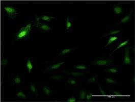 Anti-PSME2 Antibody