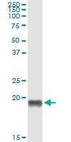 Anti-PTN Antibody