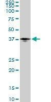 Anti-PTX3 Antibody