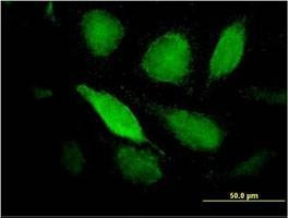 Anti-PTX3 Antibody