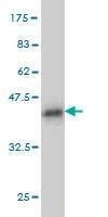 Anti-PUM2 Antibody