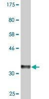Anti-PUM2 Antibody