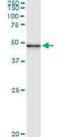 Anti-PUS1 Antibody