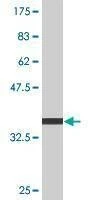 Anti-PXDN Antibody