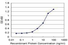 Anti-PYGM Antibody