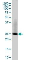 Anti-RAB3B Antibody