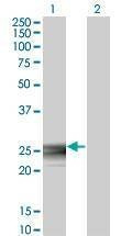 Anti-RAB3B Antibody