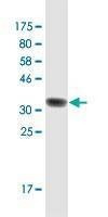 Anti-RAB3B Antibody