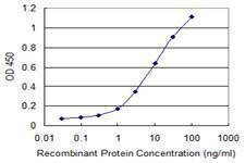 Anti-RAB7B Antibody