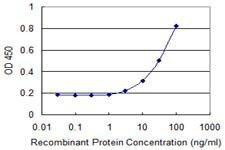 Anti-RAB7L1 Antibody