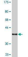 Anti-RABEP1 Antibody