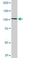 Anti-RABEP1 Antibody