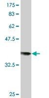Anti-RAD18 Antibody